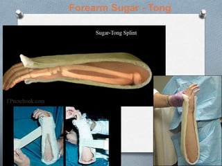 Forearm Sugar - Tong
 