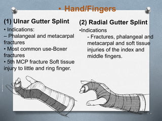 • Hand/Fingers
• Indications:
– Phalangeal and metacarpal
fractures
• Most common use-Boxer
fractures
• 5th MCP fracture Soft tissue
injury to little and ring finger.
•Indications
- Fractures, phalangeal and
metacarpal and soft tissue
injuries of the index and
middle fingers.
(2) Radial Gutter Splint(1) Ulnar Gutter Splint
 