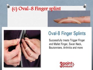 (c) Oval-8 Finger splint
 