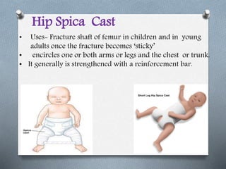 • Uses- Fracture shaft of femur in children and in young
adults once the fracture becomes ‘sticky’
• encircles one or both arms or legs and the chest or trunk.
• It generally is strengthened with a reinforcement bar.
Hip Spica Cast
 