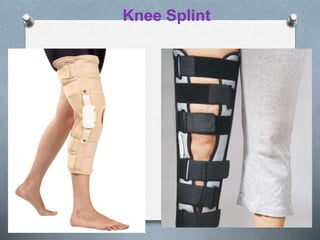 Knee Splint
 