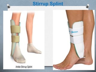 Stirrup Splint
 