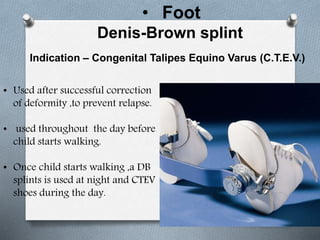 • Foot
Denis-Brown splint
Indication – Congenital Talipes Equino Varus (C.T.E.V.)
• Used after successful correction
of deformity ,to prevent relapse.
• used throughout the day before
child starts walking.
• Once child starts walking ,a DB
splints is used at night and CTEV
shoes during the day.
 