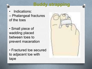 Buddy strapping
• Indications:
– Phalangeal fractures
of the toes
• Small piece of
wadding placed
between toes to
prevent maceration
• Fractured toe secured
to adjacent toe with
tape
 