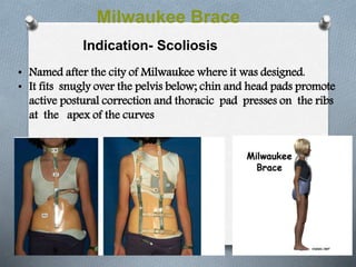 Milwaukee Brace
Indication- Scoliosis
• Named after the city of Milwaukee where it was designed.
• It fits snugly over the pelvis below; chin and head pads promote
active postural correction and thoracic pad presses on the ribs
at the apex of the curves
 