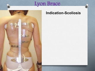Lyon Brace
Indication-Scoliosis
 