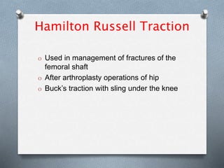 Hamilton Russell Traction
O Used in management of fractures of the
femoral shaft
O After arthroplasty operations of hip
O Buck’s traction with sling under the knee
 