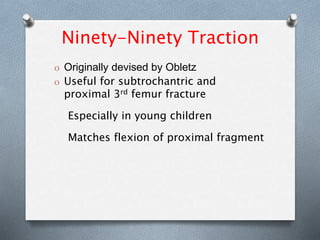 Ninety-Ninety Traction
O Originally devised by Obletz
O Useful for subtrochantric and
proximal 3rd femur fracture
Especially in young children
Matches flexion of proximal fragment
 