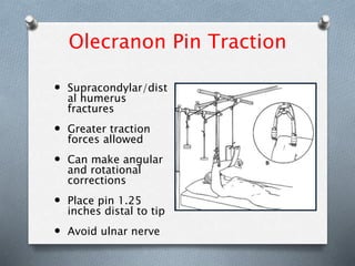 Olecranon Pin Traction
 Supracondylar/dist
al humerus
fractures
 Greater traction
forces allowed
 Can make angular
and rotational
corrections
 Place pin 1.25
inches distal to tip
 Avoid ulnar nerve
 