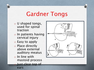 Gardner Tongs
O U shaped tongs,
used for spinal
traction
O In patients having
cervical injury
O Easy to apply
O Place directly
above external
auditory meatus
O In line with
mastoid process
O Just clear top of
ears
 