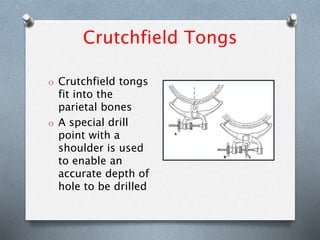Crutchfield Tongs
O Crutchfield tongs
fit into the
parietal bones
O A special drill
point with a
shoulder is used
to enable an
accurate depth of
hole to be drilled
 