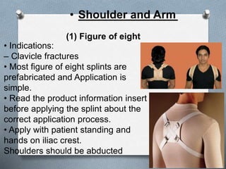 • Indications:
– Clavicle fractures
• Most figure of eight splints are
prefabricated and Application is
simple.
• Read the product information insert
before applying the splint about the
correct application process.
• Apply with patient standing and
hands on iliac crest.
Shoulders should be abducted
(1) Figure of eight
• Shoulder and Arm
 