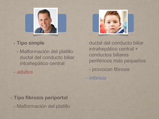 • Tipo simple
• Malformación del platillo
ductal del conducto biliar
intrahepático central
• adultos
• Tipo fibrosis periportal
• Malformación del platillo
ductal del conducto biliar
intrahepático central +
conductos biliares
periféricos más pequeños
• provocan fibrosis
• infancia
 