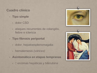Cuadro clínico
• Tipo simple
• dolor CSD
• ataques recurrentes de colangitis,
fiebre e ictericia
• Tipo fibrosis periportal
• dolor, hepatoesplenomagalia
• hematemesis (várices)
• Asintomática en etapas tempranas
• ↑ enzimas hepáticas y bilirrubina
 