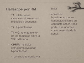 Hallazgos por RM
• T1: dilataciones
saculares hipointensas,
múltiples y pequeñas
• T2: hiperintensas
• T1 + C: reforzamiento
de los radículos entre la
VBIH dilatada
• CPRM: múltiples
estructuras ovaladas
hiperintensas
• continuidad con la vía
biliar
• contenido
hiperintenso de los
conductos biliares en
contraste con la vena
porta, que aparece
como ausencia de la
señal.
 