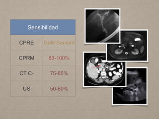 Sensibilidad
CPRE Gold Santard
CPRM 83-100%
CT C- 75-85%
US 50-60%
 