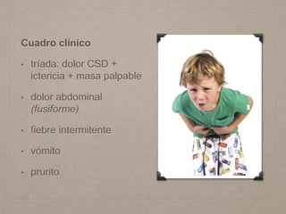 Cuadro clínico
• tríada: dolor CSD +
ictericia + masa palpable
• dolor abdominal
(fusiforme)
• fiebre intermitente
• vómito
• prurito
 