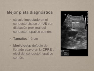 Mejor pista diagnóstica
• cálculo impactado en el
conducto cístico en US con
dilatación proximal del
conducto hepático común.
• Tamaño: 1-3 cm
• Morfología: defecto de
llenado suave en la CPRE a
nivel del conducto hepático
común.
 