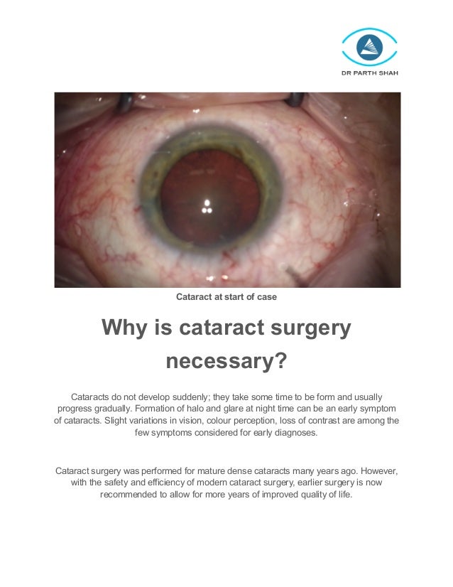 Traditional cataract surgery vs laser assisted cataract surgery