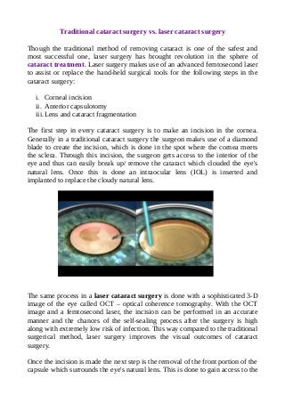 Traditional vs laser cataract surgery
