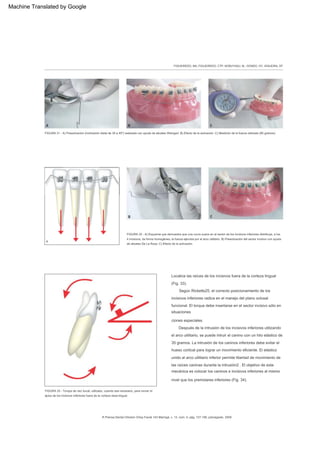 traductor Arco utilitario de rickets versatilidad clinica | PDF