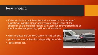 Rear impact.
• If the victim is struck from behind, a characteristic series of
superficial, parallel linear and irregular linear tears of the
abdomen or the inguinal regions are seen due to overstretching of
the skin which appear dry, yellow and bloodless
• Many impacts are on front corner of the car and
• pedestrian may be knocked diagonally out of the
• path of the car.
 