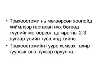 • Трахеостоми нь мөгөөрсөн хоолойд
хиймлээр гаргасан нүх бөгөөд
түүнийг мөгөөрсөн цагирагны 2-3
дугаар үеийн түвшинд хийнэ.
• Трахеостомийн гуурс хэмээх тахир
гуурсыг энэ нүхээр оруулна.

 
