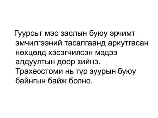 Гуурсыг мэс заслын буюу эрчимт
эмчилгээний тасалгаанд ариутгасан
нөхцөлд хэсэгчилсэн мэдээ
алдуултын доор хийнэ.
Трахеостоми нь түр зуурын буюу
байнгын байж болно.

 
