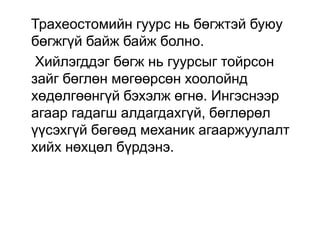 Трахеостомийн гуурс нь бөгжтэй буюу
бөгжгүй байж байж болно.
Хийлэгддэг бөгж нь гуурсыг тойрсон
зайг бөглөн мөгөөрсөн хоолойнд
хөдөлгөөнгүй бэхэлж өгнө. Ингэснээр
агаар гадагш алдагдахгүй, бөглөрөл
үүсэхгүй бөгөөд механик агааржуулалт
хийх нөхцөл бүрдэнэ.

 