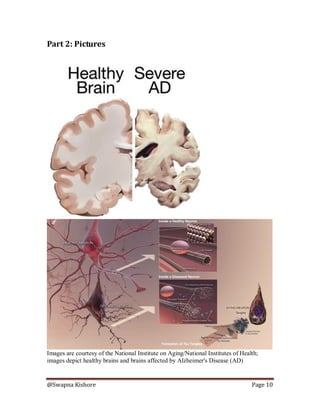 @Swapna Kishore Page 10
Part 2: Pictures
Images are courtesy of the National Institute on Aging/National Institutes of Health;
images depict healthy brains and brains affected by Alzheimer's Disease (AD)
 