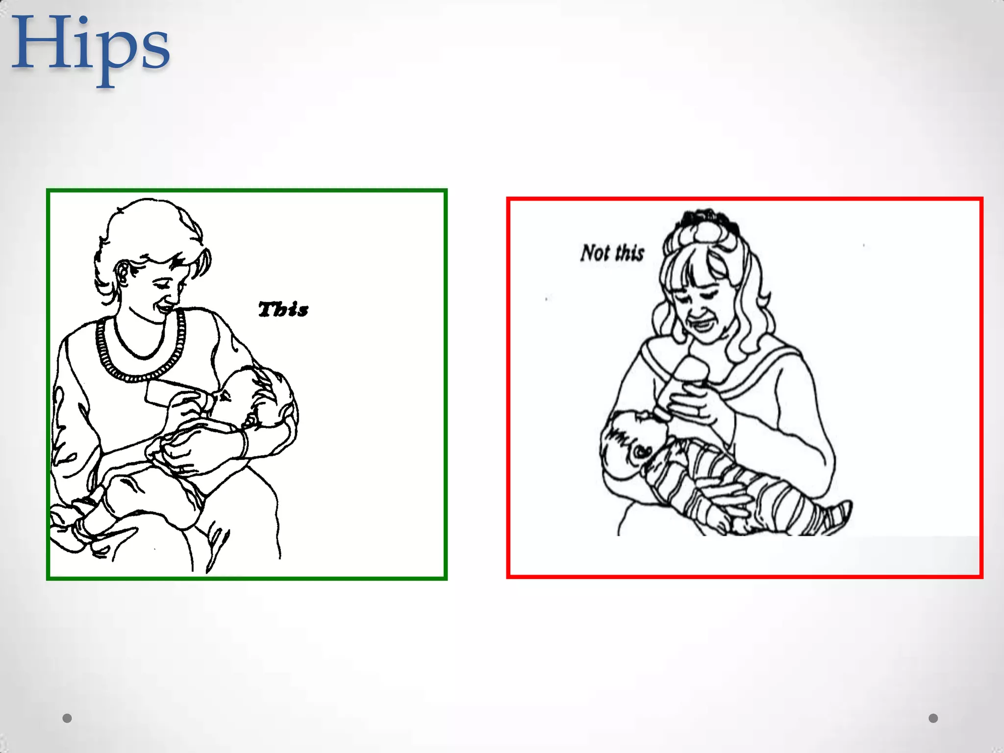 Hips
 