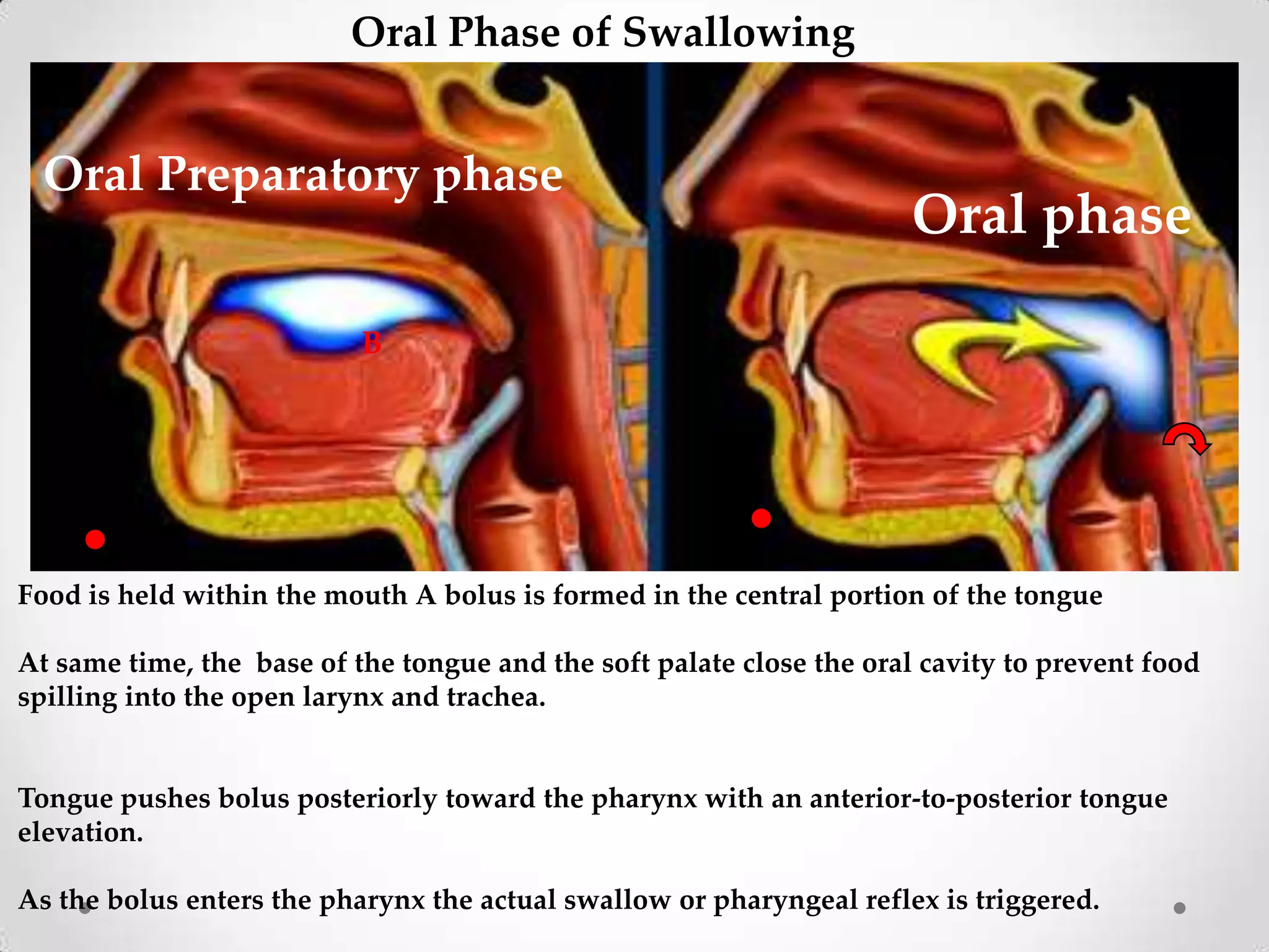 Oral Phase of Swallowing


  Oral Preparatory phase
                                                                       Oral phase

                           B




Food is held within the mouth A bolus is formed in the central portion of the tongue

At same time, the base of the tongue and the soft palate close the oral cavity to prevent food
spilling into the open larynx and trachea.


Tongue pushes bolus posteriorly toward the pharynx with an anterior-to-posterior tongue
elevation.

As the bolus enters the pharynx the actual swallow or pharyngeal reflex is triggered.
 