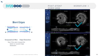Edge Dissection Training in a Box - Acute Cornary Syndrome - Oxford Edition.pptx