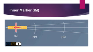 Inner Marker (IM)
 