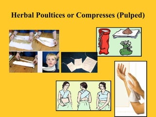 Herbal Poultices or Compresses (Pulped)
 