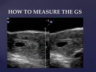 HOW TO MEASURE THE GS
 