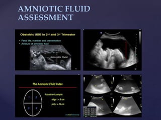 {
AMNIOTIC FLUID
ASSESSMENT
 
