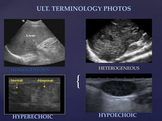 {
HOMOGENEOUS HETEROGENEOUS
HYPERECHOIC HYPOECHOIC
ULT. TERMINOLOGY PHOTOS
 