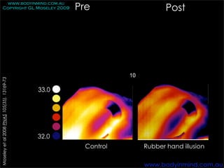 Pre
         www.bodyinmind.com.au
        Copyright GL Moseley 2009                                          Post




                                                               10
Moseley et al 2008 PNAS 105(35), 13169-73




                                            33.0




                                            32.0
                                                     Control        Rubber hand illusion

                                                                    www.bodyinmind.com.au
 