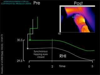 Pre
         www.bodyinmind.com.au
        Copyright GL Moseley 2009                                                Post




                                                                          10
Moseley et al 2008 PNAS 105(35), 13169-73




                                            30.5



                                                       Synchronous
                                                       tapping eyes
                                                          closed           RHI
                                            29.5

                                                   0                  2   Time          5
 
