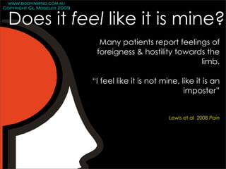 www.bodyinmind.com.au
Copyright GL Moseley 2009


  Does it feel like it is mine?
                              Many patients report feelings of
                             foreigness & hostility towards the
                                                          limb.

                            “I feel like it is not mine, like it is an
                                                          imposter”


                                                     Lewis et al 2008 Pain
 