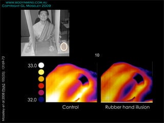 www.bodyinmind.com.au
        Copyright GL Moseley 2009




                                                             10
Moseley et al 2008 PNAS 105(35), 13169-73




                                            33.0




                                            32.0
                                                   Control        Rubber hand illusion
 