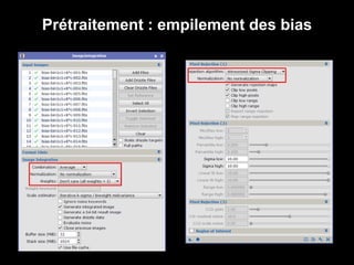 Prétraitement : empilement des bias
 