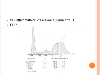  SD inflammatoire VS élevée 100mm 1ère H
 EPP
 