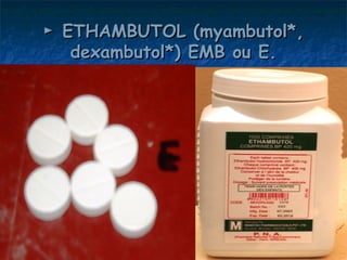 ► ETHAMBUTOL (myambutol*,
   dexambutol*) EMB ou E.
 