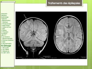 Introduction
Définitions
Epidémiologie
Traitement:
I. Médicamenteux
1- Historique
2- Principe de base
3. Mode d’action
4- Critères de Choix
a- MAE:
b- Patients:
5- Prescription
Surveillance
effet II aire
6- Les Indications
7. Mesures associées
8. Pharmaco résistance
II. Diète:
III. Neurostimulation
IV. Chirurgie
1- TRT Curatif
2- TRT Palliatif
VI. Mode de vie
VII. JNLF / 2014
 