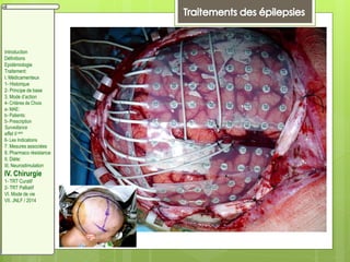 Introduction
Définitions
Epidémiologie
Traitement:
I. Médicamenteux
1- Historique
2- Principe de base
3. Mode d’action
4- Critères de Choix
a- MAE:
b- Patients:
5- Prescription
Surveillance
effet II aire
6- Les Indications
7. Mesures associées
8. Pharmaco résistance
II. Diète:
III. Neurostimulation
IV. Chirurgie
1- TRT Curatif
2- TRT Palliatif
VI. Mode de vie
VII. JNLF / 2014
 