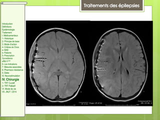 Introduction
Définitions
Epidémiologie
Traitement:
I. Médicamenteux
1- Historique
2- Principe de base
3. Mode d’action
4- Critères de Choix
a- MAE:
b- Patients:
5- Prescription
Surveillance
effet II aire
6- Les Indications
7. Mesures associées
8. Pharmaco résistance
II. Diète:
III. Neurostimulation
IV. Chirurgie
1- TRT Curatif
2- TRT Palliatif
VI. Mode de vie
VII. JNLF / 2014
 
