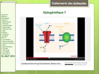 Introduction
Définitions
Epidémiologie
Traitement:
I. Médicamenteux
1- Historique
2- Principe de base
3. Mode d’action
4- Critères de Choix
a- MAE:
b- Patients:
5- Prescription
Surveillance
effet II aire
6- Les Indications
7. Mesures associées
8. Pharmaco résistance
II. Diète:
III. Neurostimulation
IV. Chirurgie
1- TRT Curatif
2- TRT Palliatif
VI. Mode de vie
VII. JNLF / 2014
Optogénétique ?
 