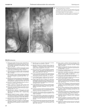 34-450-D-10 Traitement endovasculaire des varicocèles Radiodiagnostic 
Références 
[1] Abdulmaaboud MR, Shokeir AA, Farage Y, Abd El-Rahman 
A, El-Rakhawy MM et al. Treatment of varicocele: a com-parative 
study of conventional open surgery, percutane-ous 
retrograde sclerotherapy, and laparoscopy. Urology 
1998 ; 52 : 294-300 
[2] Ahlberg NE, Bartley O, Chidekel N. Retrograde contrast 
filling of the left gonadal vein. A roentgenologic and ana-tomical 
study. Acta Radiol Diagn 1965 ; 3 : 385-392 
[3] Ahlberg NE, Bartley O, Chidekel N. Right and left gonadal 
veins.Ananatomicalandstatistical study. Acta RadiolDiagn 
1966 : 4 : 593-601 
[4] Bähren W, Biehl C, Danz B. Failed sclerotherapy trials with 
the v. spermatica interna. A retrospective analysis in 1141 
patients with idiopathic varicocele. ROFO 1992 ; 157 : 
355-360 
[5] BährenW,LenzM,PorstH,WierschinW.NebenwirKunger, 
komplikationen und kontraindikationen der perkutanen 
sklerotherapie der v. spermatica interna zur Behandlund 
der idiopathischen varikozele. ROFO 1983 ; 138 : 172-179 
[6] Bensussan D, Huguet JF. Radiological anatomy of the tes-ticular 
vein. Anat Clin 1984 ; 6 : 143-154 
[7] Berger T, Sörensen R. Varicoceles: distal occlusion with 
coaxial catheter system. Radiology 1987 ; 162 (1 Pt 1) : 271 
[8] Berkman WA, Price RB, Wheatley JK, Fajman WA, Sones PJ, 
Casarella WJ. Varicoceles: a coaxial coil occlusion system. 
Radiology 1984 ; 151 : 73-77 
[9] Bigot JM, Barret F, Hélénon C. Phlebography of the right 
spermatic vein in varicoceles. In : Jecht EW, Zeitler E eds. 
Varicocele and male infertility. Berlin : Springer Verlag, 
1982 : 59-67 
[10] Bigot JM, Carette MF, Toueg C, Le Breton C. Sclérose et 
traitements endovasculaires des varicocèles. In : Duvaufer-rier 
R, Ramée A, Guibert JL éd. Radiologie et échographie 
interventionnelles. Montpellier : Axone, 1986 : 604-610 
[11] Bigot JM, Chatel A. The value of retrograde spermatic phle-bography 
in varicocele. Eur Urol 1980 ; 6 : 301-306 
[12] Bigot JM, Chatel A, Dectot H, Hélénon CH. Phlébographie 
spermatique rétrograde. Technique et anatomie radiolo-gique. 
Àpropos de 152 explorations. Ann Radiol1978;21 : 
515-523 
42 Aspect postopératoire et récidives. 
[13] Bigot JM, Jousse D, Carette MF, Delafontaine D. Sclérose 
des varicocèles. Ann Urol 1985 ; 6 : 393-397 
[14] Bigot JM, Le Blanche AF, Carette MF, Gagey N, Bazot M, 
Boudghène F. Anastomoses between the spermatic and 
visceral veins: a retrospective study of 500 consecutive 
patients. Abdom Imaging 1997 ; 22 : 226-232 
[15] Bruns T, Born O, Ergun S, Tauber R. Antegrade scrotal phle-bography 
of the v. spermatica in left-sided testicular vari-cocele 
- are retrograde phlebographic classifications suit-able 
for typing. ROFO 1997 ; 166 : 44-50 
[16] Cayan S, Lee D, Black LD, Reijo Pera RA, Turek PJ. Response 
to varicocelectomy in oligospermic men with and without 
defined genetic infertility. Urology 2001 ; 57 : 530-535 
[17] Chatel A, Bigot JM, Barret F, Hélénon CH. Veines spermati-ques, 
voies de suppléance. J Radiol 1979 ; 60 : 121-127 
[18] Chatel A, Bigot JM, Dectot H, Hélénon CH. Intérêt de la 
phlébographie spermatique dans le diagnostic des stérili-tés 
d’origine circulatoire (varicocèle). Comparaison avec 
des données cliniques thermographiques et anatomiques. 
Ann Radiol 1978 ; 21 : 565-570 
[19] Chatel A, Bigot JM,DectotH,HélénonCH.Anatomieradio-logique 
des veines spermatiques. À propos de 152 phlébo-graphies 
spermatiques rétrogrades. J Chir 1978 ; 115 : 
443-450 
[20] Comhaire F, Kunnen M. Selective retrograde venography 
of the internal spermatic vein: a conclusive approach to the 
diagnostic of varicocele. Andrologia 1976 ; 8 : 11-24 
[21] Coolsaet BL. The varicocele syndrome: venography deter-mining 
the optimal level for surgical management. J Urol 
1980 ; 124 : 833-839 
[22] Corvin S, Liedl B,AdamC, Zaak D, Reich O, Sturminger P et 
al. Simultaneous microsurgical spermatic vein ligation and 
sclerotherapy. A combined procedure for the treatment of 
recurrent or persistent varicocele. Eur Urol 2001 ; 40 : 
350-353 
[23] Daitch JA, Bedaiwy MA, Pasqualotto EB, Hendin BN, Hallak 
J, Falcone T et al. Varicocelectomy improves intrauterine 
insemination success rates in men with varicocele. J Urol 
2001 ; 165 : 1510-1513 
A. Traitement par clips (2) avec interruption de la veine 
testiculaire, mais importante dilatation d’une collatérale 
(1) donnant l’aspect d’un tronc veineux. 
B. Le traitement par un guide-cathéter (1) a permis aisé-ment 
de retrouver le tronc principal et de le scléroser. 
[24] Ergun S, Bruns T, Tauber R. Vascular organization of the 
pampiniformis plexus in the man and its significance for 
antegrade sclerosing of testicular varicocele. UrologeA 
1996 ; 35 : 463-467 
[25] Falappa P, Cotroneo AR. Varicocele: percutaneous sclero-therapy 
ofgonadalveinescomparedto surgical treatment. 
Eur J Radiol 1982 ; 2 : 119-121 
[26] FernandoN,LeonardJM,PaulsenCA.Therole of varicocele 
in male fertility. Andrologia 1976 ; 8 : 1-9 
[27] Fette A, Mayr J. Treatment of varicoceles in childhood and 
adolescence with Tauber’s antegrade scrotal sclero-therapy. 
J Pediatr Surg 2000 ; 35 : 1222-1225 
[28] Ficola F, Ciaccio V. Bilateralandsubclinical varicocele: clini-cal 
experience. Minerva Chir 1995 ; 50 : 999-1003 
[29] Fontaine E, BenoitG,Jardin A,BeurtonD.Varicocele inado-lescents. 
Prog Urol 2000 ; 10 : 1099-1107 
[30] FormanekA,RusnakB, ZollikoferC,Castaneda-ZunigaWR, 
Narayan P, Gonzalez R et al. Embolization of the spermatic 
vein for treatment of infertility: a new approach. Radiology 
1981 ; 139 : 315-321 
[31] Fuochi C, Moser E, Dalla Palma F, AndermarcherM,Defant 
G, Failoni G et al. Sclerotherapy of varicocele. Efficacy of 
radiological, clinical and seminal treatment. J Urol 1990 ; 
96 : 217-222 
[32] Fuochi C, Moser E, Dalla Palma F, Defant G, Andermarcher 
M, Luciani L. Value of percutaneous sclerotherapy in the 
treatment of varicocele. Techniques and results. Ann Urol 
1986 ; 20 : 252-256 
[33] Goll A, Albers P, Schoeneich G, Haidl G, Burger R. Testicular 
lossduetohemorrhagicinfarct inTauberantegrade scrotal 
varicocele sclerotherapy. Urologe A 1997 ; 36 : 449-451 
[34] Gondra RL Jr, Karo JJ, Forte RA, O’Donnell KT. Diagnosis of 
subclinical varicocele in infertility. AJR Am J Roentgenol 
1987 ; 148 : 71-75 
[35] Gonzalez R, Narayan P, Formanek A, Amplatz K. Trans-venous 
embolization of internal spermatic veins: nonop-erative 
approach to treatment of varicocele. Urology1981; 
17 : 246-248 
[36] Hargreave TB. Debate on the pros and cons of varicocele 
treatment in favour of varicocele treatment. Hum Reprod 
1995 ; 10 : 151-157 
*A *B 
24 
 